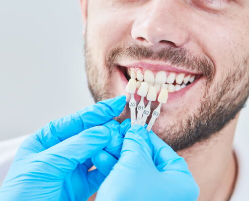 Mann mit zusammengebissenen Zähnen vor denen einige Farbmuster gehalten werden